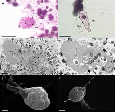 In vitro induction of Entamoeba gingivalis cyst-like structures from trophozoites in response to antibiotic treatment